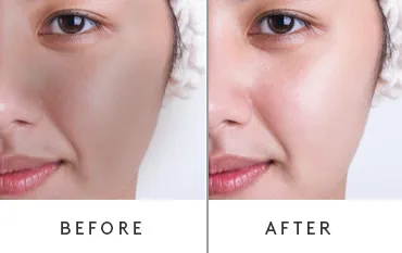 Before & After